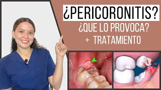 Pericoronitis  Pericoronaritis  Qué es y tratamiento  Odontología Con Cri [upl. by Ydaf]