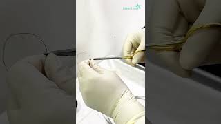 Biopsy for histopathology  Dhaka Dermatology Institute  LaserTreat [upl. by Penhall]