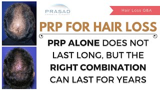 Monthly PRP Hair Loss Injections Have Limited Results  Combo Treatment Lasts Years with 1 Treatment [upl. by Broddie]