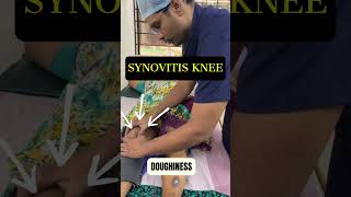 Knee swelling  Synovitis kneepain osteoarthritis shorts [upl. by Anilecram447]