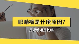 乾眼症還是結膜炎？先了解眼睛癢是什麼原因！低頭族乾眼症2方法舒緩！ft 陳瑩山醫師【醫師在線等 】 [upl. by Druce]