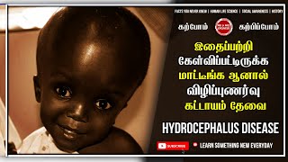 இதைப்பற்றி கேள்விபற்றுக்கமாட்டீங்க ஆனால் விழிப்புணர்வு கட்டாயம் தேவை  Hydrocephalus in Tamil [upl. by Davena]