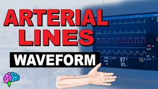 The Arterial Line Waveform EXPLAINED [upl. by Maccarone]