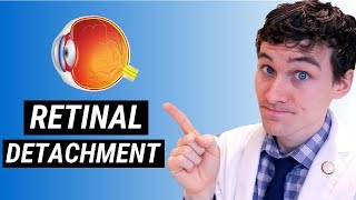 Retinal Detachment Symptoms and Treatment  How Retinal Detachment is Treated [upl. by Xela]