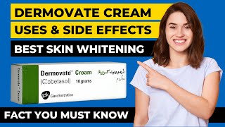 dermovate cream review  How to use  benefits  side effects  dermovate cream for acne [upl. by Inalaehak]