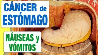 Síntomas del cáncer de estómago  Náuseas y vómitos [upl. by Mosera719]