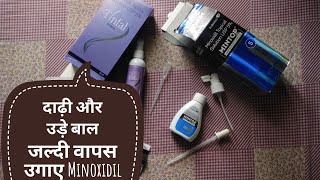 Minoxidil 5 Beard Growth and Hair regrowth  Baldness and Beard Patch Review with Proof [upl. by Ayrotal]