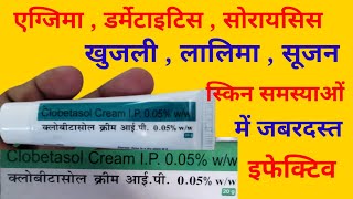 Clobetasol Cream IP Uses in Hindi  क्लोबिटासोल क्रीम के उपयोग [upl. by Wertz]