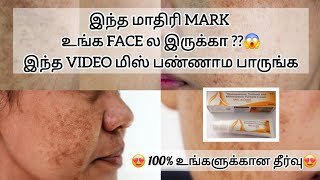 face black mark remove cream best result tamil [upl. by Dole]