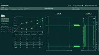 78 BulbiCAM Smooth Vergence test explanation [upl. by Marilee]