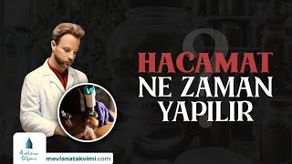 Hacamat Ne Zaman Yapılır [upl. by Caryl]