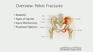 Treatment of Common Geriatric Fractures Spine and Pelvis [upl. by Middle]