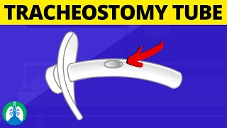 Tracheostomy Tube Medical Definition  Quick Explainer Video [upl. by Atiekram]