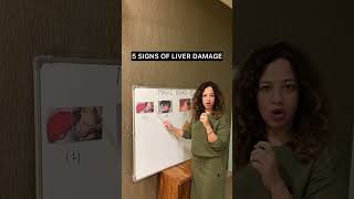 IS YOUR LIVER DAMAGED ft Sonia Narang fattyliver liverdetox nutrition health wellness [upl. by Liliane]