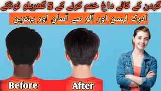 Remove neck darkness in 10 mins at homeکالی گردن کو سفید کرنے کا طریقہ 😱💯 beautytips skincare [upl. by Anikat]