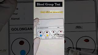 Blood Grouping youtubeshorts laboratory shorts dmlt serology [upl. by Airenahs]