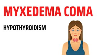 Myxedema Coma  Hypothyroidism [upl. by Aivan]