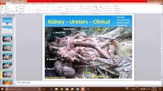 Aorta–IVC–Kidney Dissection and Surgical Correlations  Dr Sanjoy Sanyal [upl. by Verge52]