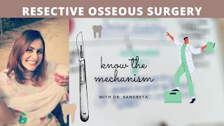 resective osseous surgery in periodontics [upl. by Reivaj462]