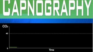 EtCO2 Capnography Part 3 [upl. by Suoirrad]