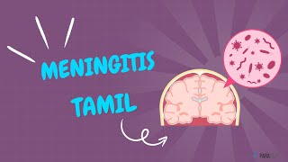 Meningitis in Tamil Definition Symptoms Causes Diagnosis and Management [upl. by Begga]