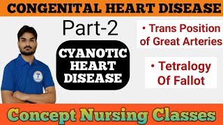 Congenital Heart Disease Part2 Cyanotic Heart Disease Tetralogy Of Fallot [upl. by Weatherby101]