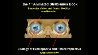 Etiology of Heterophoria and Heterotropia [upl. by Oinigih292]