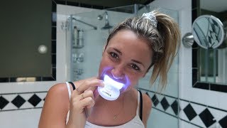 Do athome teeth whitening kits really work  Glam Lab [upl. by Etnovahs110]