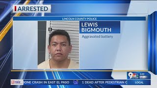 Docs Assault leaves man with partially amputated nose 1 charged [upl. by Padget]