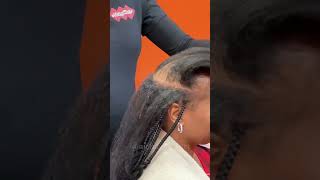 ALOPECIA HAIR BRAIDING TECHNIQUE  Keep Your Hair Looking Good When You Have ALOPECIA [upl. by Paola]