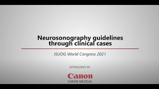 ISUOG 2021 Miguel Branco – Neurosonography guidelines through clinical cases [upl. by Nuahsak]