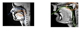 velar movement and nasal sounds [upl. by Laehcym268]