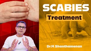 Treatment for Scabies தமிழ்  DrShanthamenan scabies treatment healthy healthylifestyle [upl. by Omari]