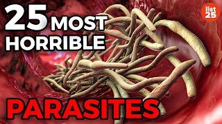 25 Parasites You Do Not Want To Be Infected With [upl. by Alah]