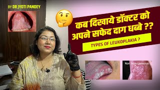 कब दिखाये डॉक्टर को अपने सफेद दाग धब्बे  Types of LEUKOPLAKIA… [upl. by Ahsienel]