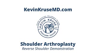 Reverse Shoulder Arthroplasty Demonstration  Dr Kevin Kruse MD [upl. by Anits400]