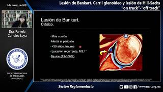 Sesión ReglamentariaLesión de BankartCarril glenoideo y lesión de HillSachs quoton trackquot  quotof tra [upl. by Hanauq]