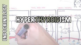 Hyperthyroidism Overview causes pathophysiology [upl. by Aneleiram]