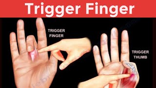 Trigger finger in Urdu Hindi Causes Symptoms and Physiotherapy treatment and Exercise [upl. by Chauncey372]