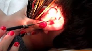 Ear cleaning video how to remove huge earwax Its really fun to watch [upl. by Ydeh]