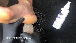 Footlogix Callus Softener by Juren Beauty [upl. by Welles483]