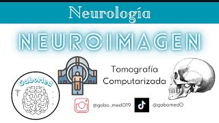 Neuroimagen  Tomografía Computarizada [upl. by Nicholas]