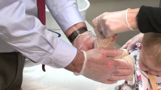 Osteogenesis Imperfecta  Long Arm and Long Leg Splint Demonstrations [upl. by Gothart205]