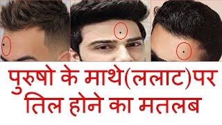 पुरुषो के माथे ललाट पर तिल होने का मतलब  Moles on forehead and its meaning  mathe par til [upl. by Chor]