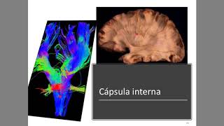 Hemisferios cerebrales  Configuración interna Parte 2 de 3 [upl. by Blanche]