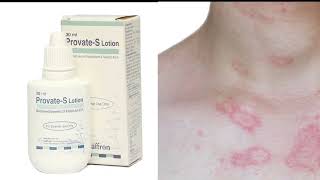 Allergy Eczematreatment in urduProvate S lotion Uses benefits and disadvanteges in urdu [upl. by Boswell]