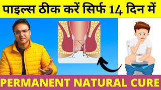 Piles Treatment पुराने से पुराना पाइल्स बवासीर 14 दिन में जड़ से ठीक करें  Piles Home Treatment [upl. by Gnad]