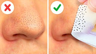 22 EASY WAYS TO REMOVE BLACKHEADS FAST  FACE MASKS NATURAL BEAUTY HACKS [upl. by Nosreme]