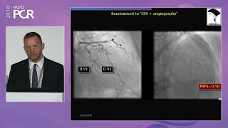 COMET advancing the use of physiology in PCI from routine to complex cases [upl. by Trebuh]