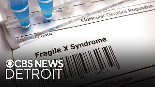 Breaking down Fragile X Syndrome [upl. by Alemat]